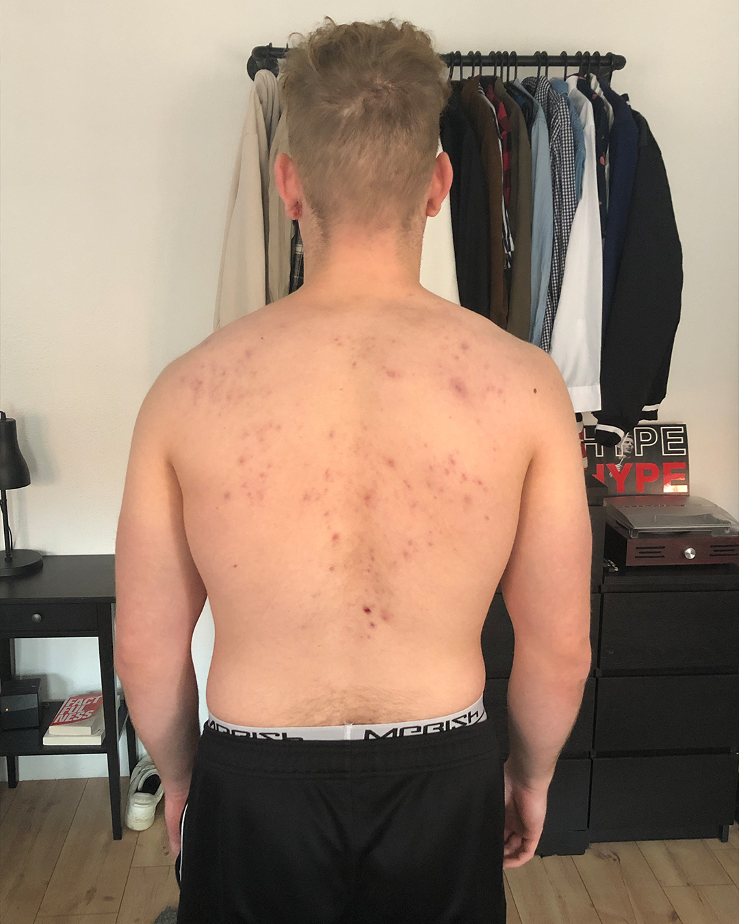 back