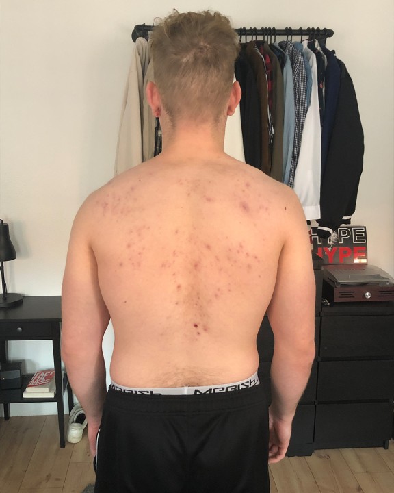 back
